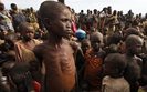Po kl�sce g�odu w Somalii wybuch�a gro�na epidemia