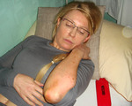 Julia Tymoszenko b�dzie leczona poza murami wi�zienia